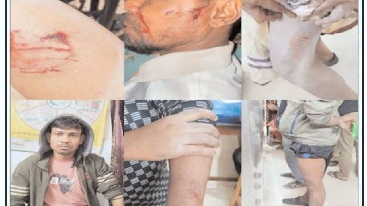 ২৪ ঘণ্টায় ৪০ জন আহত, ভেড়ামারায় জলাতঙ্ক শঙ্কা