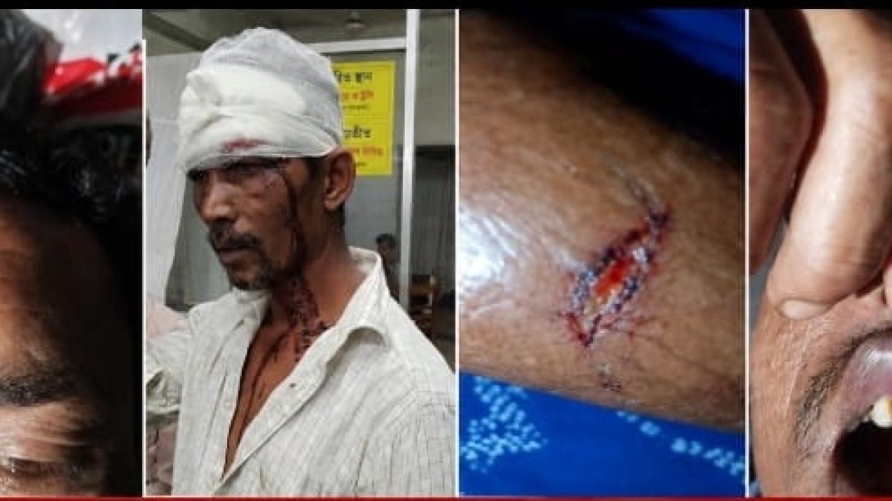 ছাতকে পূর্ববিরোধের জেরে সংঘর্ষ: হত্যাচেষ্টা, গুরুতর জখম ও ছিনতাইয়ের অভিযোগে ১৭ জনের বিরুদ্ধে মামলা